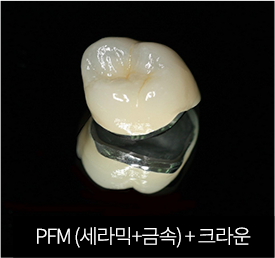 PFM + 크라운