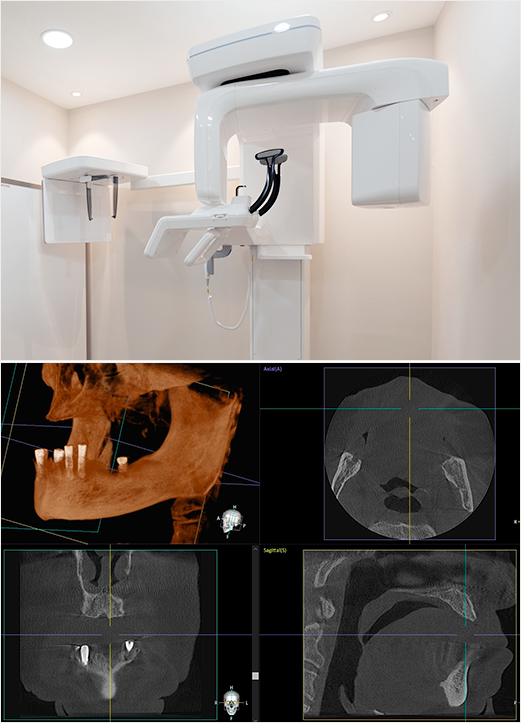 대학병원급 3D CT