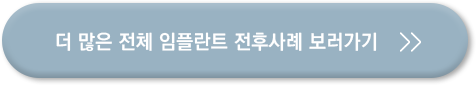 더 많은 전체 임플란트 전후사례 보러가기