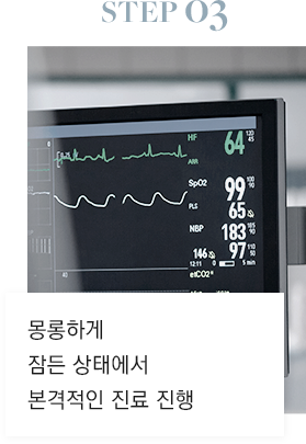 STEP 03 몽롱하게 잠든 상태에서 본격적인 진료 진행