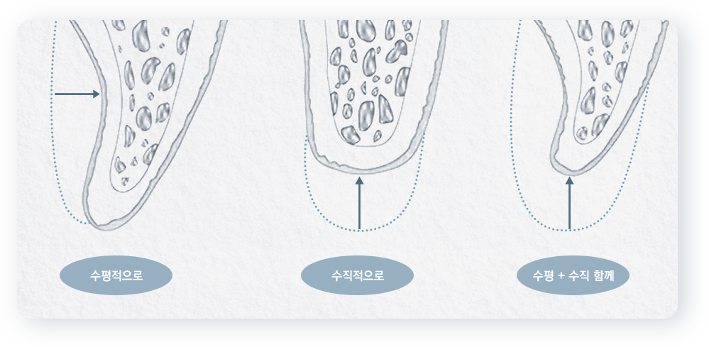 수평적으로, 수직적으로, 수평, 수직 함께