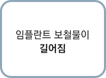 임플란트 보철물이 길어짐