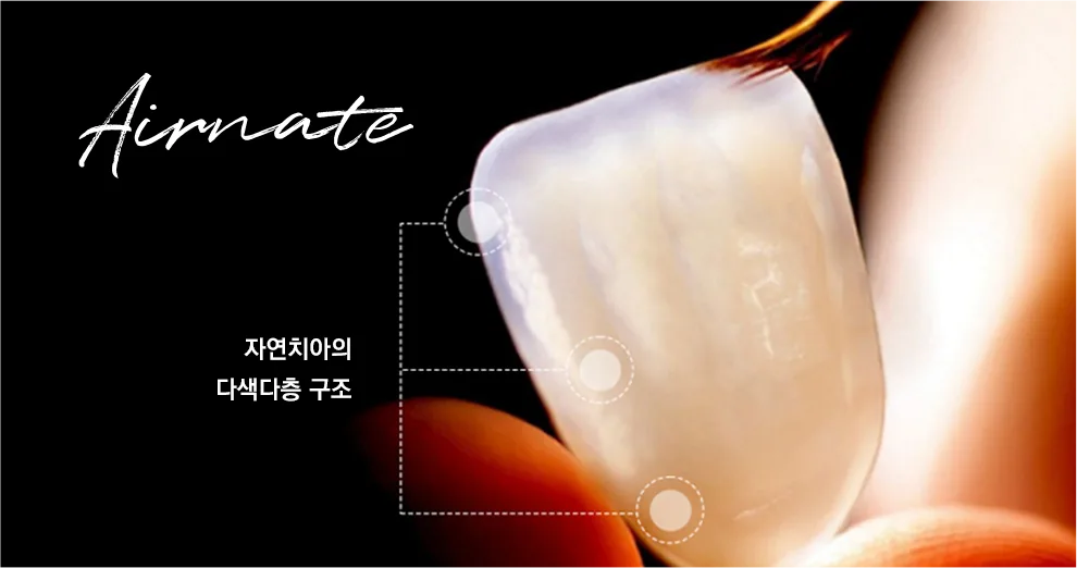 에어네이트 보철의 치아 다층 구조를 표시한 그림